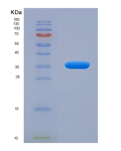 SDS-PAGE analysis of Human RELA (Transcription Factor P65) - Recombinant Protein, showing >90% purity under 15% SDS-PAGE (Reduced)