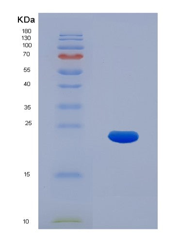 SDS-PAGE analysis of Human KRT17 (Keratin, Type I Cytoskeletal 17) - Recombinant Protein, showing >95% purity under 15% SDS-PAGE (Reduced)