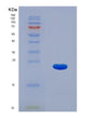 SDS-PAGE analysis of Human KRT17 (Keratin, Type I Cytoskeletal 17) - Recombinant Protein, showing >95% purity under 15% SDS-PAGE (Reduced)