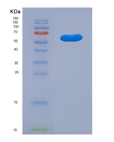 SDS-PAGE analysis of Human KDSR (3-Ketodihydrosphingosine Reductase) - Recombinant Protein, showing >90% purity under 15% SDS-PAGE (Reduced)