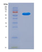 SDS-PAGE analysis of Human KDSR (3-Ketodihydrosphingosine Reductase) - Recombinant Protein, showing >90% purity under 15% SDS-PAGE (Reduced)