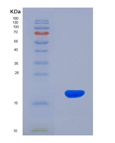 SDS-PAGE analysis of Human GP6 (Platelet Glycoprotein Vi) - Recombinant Protein, showing >90% purity under 15% SDS-PAGE (Reduced)