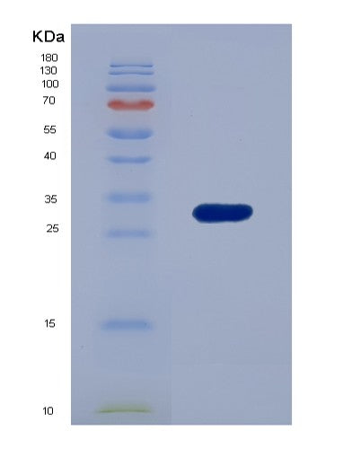 SDS-PAGE analysis of Human C1QBP (Complement Component 1 Q Subcomponent-Binding Protein, Mitochondrial) - Recombinant Protein, showing >85% purity under 15% SDS-PAGE (Reduced)