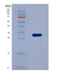 SDS-PAGE analysis of Human C1QBP (Complement Component 1 Q Subcomponent-Binding Protein, Mitochondrial) - Recombinant Protein, showing >85% purity under 15% SDS-PAGE (Reduced)