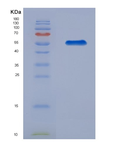 SDS-PAGE analysis of Human RGS1 (Regulator Of G-Protein Signaling 1) - Recombinant Protein, showing >85% purity under 15% SDS-PAGE (Reduced)