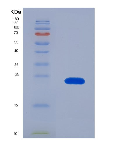 SDS-PAGE analysis of Human NOG (Noggin) - Recombinant Protein, showing >90% purity under 15% SDS-PAGE (Reduced)