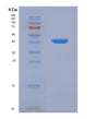 SDS-PAGE analysis of Human SYCN (Syncollin) - Recombinant Protein, showing >90% purity under 15% SDS-PAGE (Reduced)