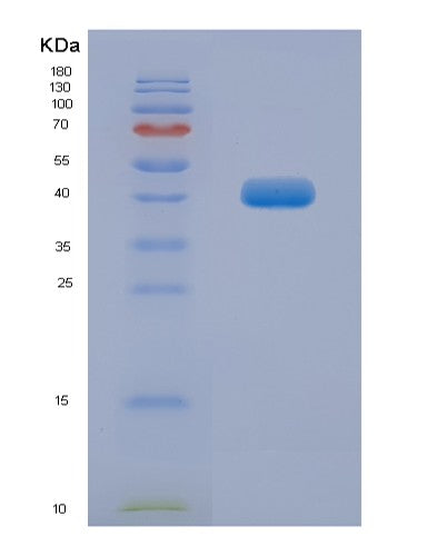 SDS-PAGE analysis of Human TEF (Thyrotroph Embryonic Factor) - Recombinant Protein, showing >95% purity under 15% SDS-PAGE (Reduced)