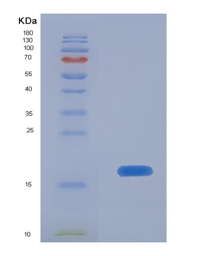 SDS-PAGE analysis of Human BST2 (Bone Marrow Stromal Antigen 2) - Recombinant Protein, showing >90% purity under 15% SDS-PAGE (Reduced)