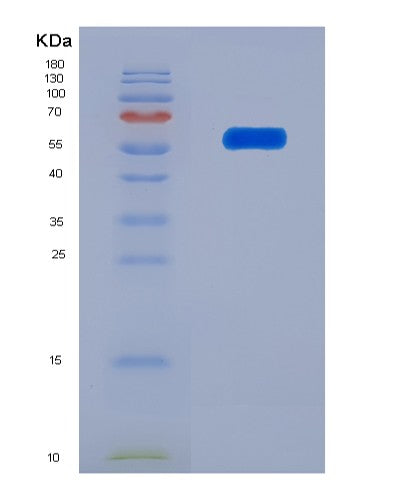 SDS-PAGE analysis of Human SCRN1 (Secernin-1) - Recombinant Protein, showing >95% purity under 15% SDS-PAGE (Reduced)