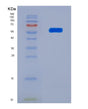 SDS-PAGE analysis of Human SCRN1 (Secernin-1) - Recombinant Protein, showing >95% purity under 15% SDS-PAGE (Reduced)
