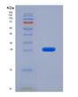 SDS-PAGE analysis of Human ASPH (Aspartyl/Asparaginyl Beta-Hydroxylase) - Recombinant Protein, showing >85% purity under 15% SDS-PAGE (Reduced)