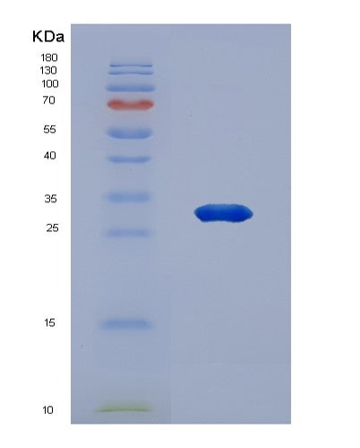SDS-PAGE analysis of Human ADCY2 (Adenylate Cyclase Type 2) - Recombinant Protein, showing >90% purity under 15% SDS-PAGE (Reduced)