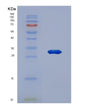 SDS-PAGE analysis of Human ADCY2 (Adenylate Cyclase Type 2) - Recombinant Protein, showing >90% purity under 15% SDS-PAGE (Reduced)