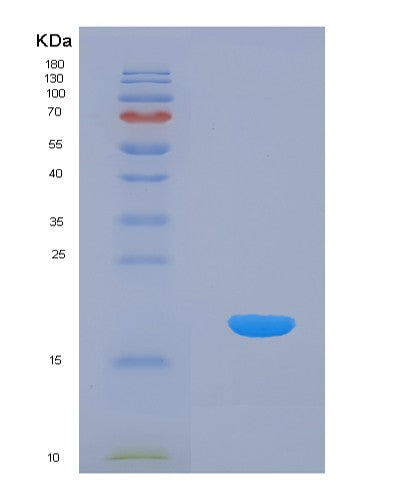 SDS-PAGE analysis of Human AIMP1 (Aminoacyl Trna Synthase Complex-Interacting Multifunctional Protein 1) - Recombinant Protein, showing >85% purity under 15% SDS-PAGE (Reduced)