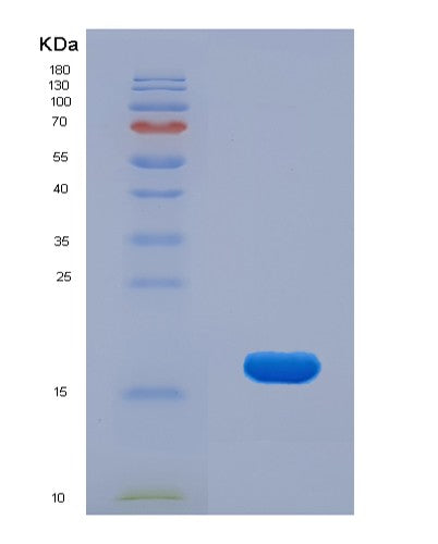 SDS-PAGE analysis of Human KLRB1 (Killer Cell Lectin-Like Receptor Subfamily B Member 1) - Recombinant Protein, showing >95% purity under 15% SDS-PAGE (Reduced)