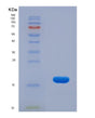 SDS-PAGE analysis of Human KLRB1 (Killer Cell Lectin-Like Receptor Subfamily B Member 1) - Recombinant Protein, showing >95% purity under 15% SDS-PAGE (Reduced)