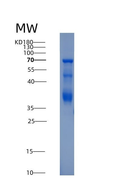 SDS-PAGE analysis of Human HTR1A (5-Hydroxytryptamine Receptor 1A) - Recombinant Protein, showing >80% purity under 15% SDS-PAGE (Reduced)