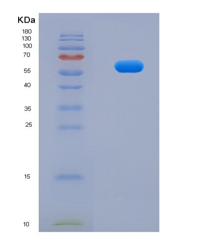 SDS-PAGE analysis of Human BNIP3 (Bcl2/Adenovirus E1B 19 Kda Protein-Interacting Protein 3) - Recombinant Protein, showing >95% purity under 15% SDS-PAGE (Reduced)
