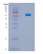 SDS-PAGE analysis of Human BNIP3 (Bcl2/Adenovirus E1B 19 Kda Protein-Interacting Protein 3) - Recombinant Protein, showing >95% purity under 15% SDS-PAGE (Reduced)