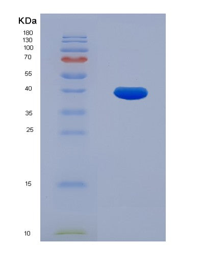 SDS-PAGE analysis of Human ECH1 (Delta(3,5)-Delta(2,4)-Dienoyl-Coa Isomerase, Mitochondrial) - Recombinant Protein, showing >85% purity under 15% SDS-PAGE (Reduced)