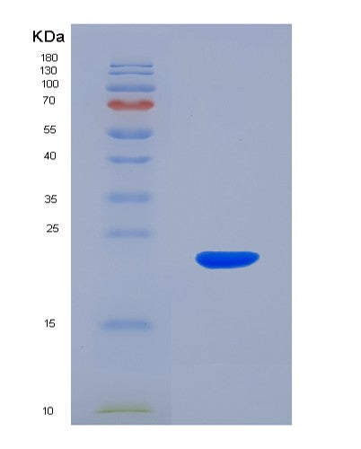 SDS-PAGE analysis of Human NME3 (Nucleoside Diphosphate Kinase 3) - Recombinant Protein, showing >90% purity under 15% SDS-PAGE (Reduced)