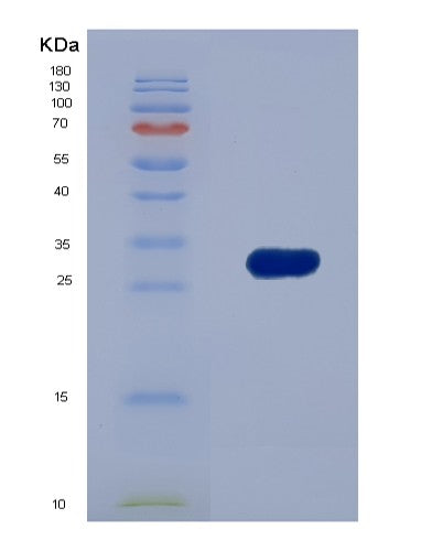 SDS-PAGE analysis of Human CTBP1 (C-Terminal-Binding Protein 1) - Recombinant Protein, showing >90% purity under 15% SDS-PAGE (Reduced)