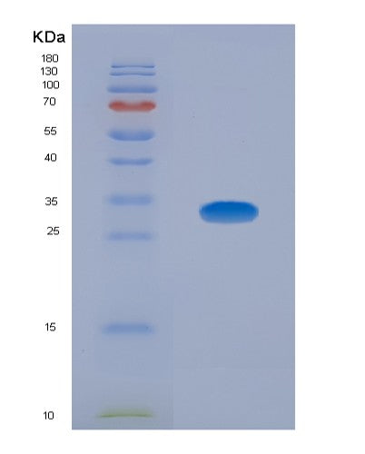 SDS-PAGE analysis of Human SQSTM1 (Sequestosome-1) - Recombinant Protein, showing >95% purity under 15% SDS-PAGE (Reduced)