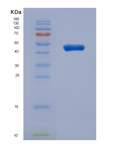 SDS-PAGE analysis of Human TUBB3 (Tubulin Beta-3 Chain) - Recombinant Protein, showing >95% purity under 15% SDS-PAGE (Reduced)