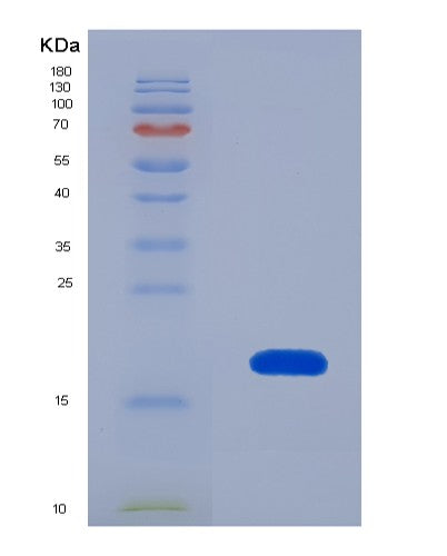 SDS-PAGE analysis of Human EIF4EBP1 (Eukaryotic Translation Initiation Factor 4E-Binding Protein 1) - Recombinant Protein, showing >90% purity under 15% SDS-PAGE (Reduced)
