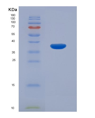 SDS-PAGE analysis of Human CAMK2B (Calcium/Calmodulin-Dependent Protein Kinase Type Ii Subunit Beta) - Recombinant Protein, showing >85% purity under 15% SDS-PAGE (Reduced)