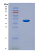 SDS-PAGE analysis of Human CAMK2B (Calcium/Calmodulin-Dependent Protein Kinase Type Ii Subunit Beta) - Recombinant Protein, showing >85% purity under 15% SDS-PAGE (Reduced)
