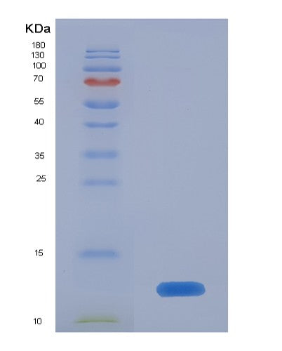 SDS-PAGE analysis of Human CD81 (Cd81 Antigen) - Recombinant Protein, showing >90% purity under 15% SDS-PAGE (Reduced)