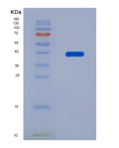 SDS-PAGE analysis of Human CD9 (Cd9 Antigen) - Recombinant Protein, showing >90% purity under 15% SDS-PAGE (Reduced)