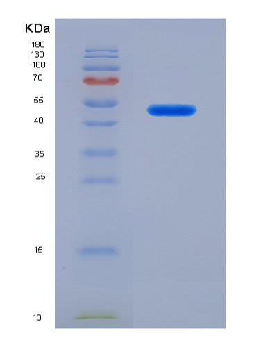 SDS-PAGE analysis of Human PDCD6IP (Programmed Cell Death 6-Interacting Protein) - Recombinant Protein, showing >90% purity under 15% SDS-PAGE (Reduced)