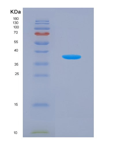 SDS-PAGE analysis of Human NAE1 (Nedd8-Activating Enzyme E1 Regulatory Subunit) - Recombinant Protein, showing >90% purity under 15% SDS-PAGE (Reduced)