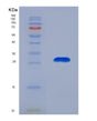 SDS-PAGE analysis of Human STIM1 (Stromal Interaction Molecule 1) - Recombinant Protein, showing >95% purity under 15% SDS-PAGE (Reduced)
