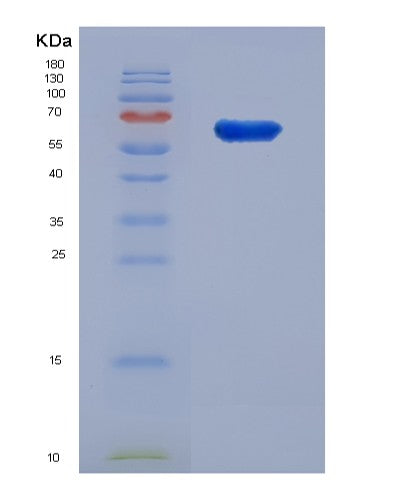 SDS-PAGE analysis of Human SNX1 (Sorting Nexin-1) - Recombinant Protein, showing >90% purity under 15% SDS-PAGE (Reduced)