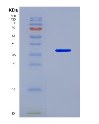 SDS-PAGE analysis of Human DYRK1A (Dual Specificity Tyrosine-Phosphorylation-Regulated Kinase 1A) - Recombinant Protein, showing >95% purity under 15% SDS-PAGE (Reduced)