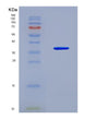 SDS-PAGE analysis of Human DYRK1A (Dual Specificity Tyrosine-Phosphorylation-Regulated Kinase 1A) - Recombinant Protein, showing >95% purity under 15% SDS-PAGE (Reduced)