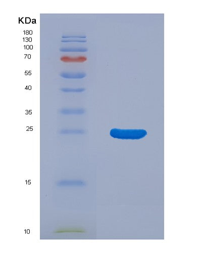 SDS-PAGE analysis of Human LGALS3BP (Galectin-3-Binding Protein) - Recombinant Protein, showing >90% purity under 15% SDS-PAGE (Reduced)