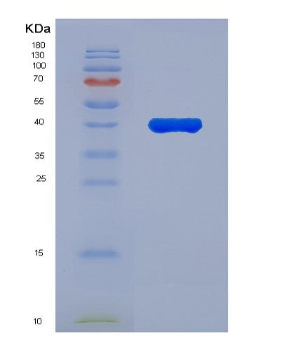 SDS-PAGE analysis of Human AUH (Methylglutaconyl-Coa Hydratase, Mitochondrial) - Recombinant Protein, showing >85% purity under 15% SDS-PAGE (Reduced)