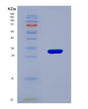 SDS-PAGE analysis of Human BLMH (Bleomycin Hydrolase) - Recombinant Protein, showing >95% purity under 15% SDS-PAGE (Reduced)