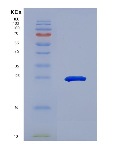 SDS-PAGE analysis of Human CBFB (Core-Binding Factor Subunit Beta) - Recombinant Protein, showing >95% purity under 15% SDS-PAGE (Reduced)