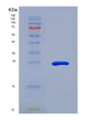 SDS-PAGE analysis of Human CBFB (Core-Binding Factor Subunit Beta) - Recombinant Protein, showing >95% purity under 15% SDS-PAGE (Reduced)