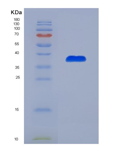 SDS-PAGE analysis of Human ICA1 (Islet Cell Autoantigen 1) - Recombinant Protein, showing >90% purity under 15% SDS-PAGE (Reduced)