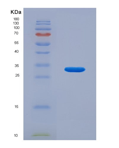 SDS-PAGE analysis of Human SEPTIN6 (Septin-6) - Recombinant Protein, showing >95% purity under 15% SDS-PAGE (Reduced)