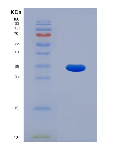 SDS-PAGE analysis of Human BECN1 (Beclin-1) - Recombinant Protein, showing >95% purity under 15% SDS-PAGE (Reduced)