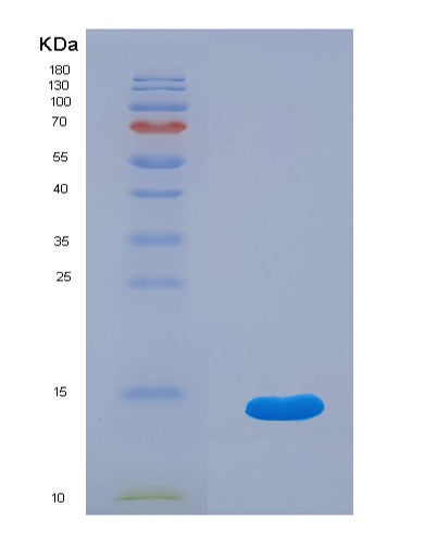 SDS-PAGE analysis of Human IL13RA2 (Interleukin-13 Receptor Subunit Alpha-2) - Recombinant Protein, showing >90% purity under 15% SDS-PAGE (Reduced)