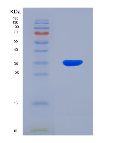 SDS-PAGE analysis of Human GNMT (Glycine N-Methyltransferase) - Recombinant Protein, showing >85% purity under 15% SDS-PAGE (Reduced)
